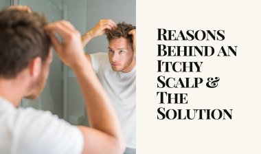Reasons Behind an Itchy Scalp