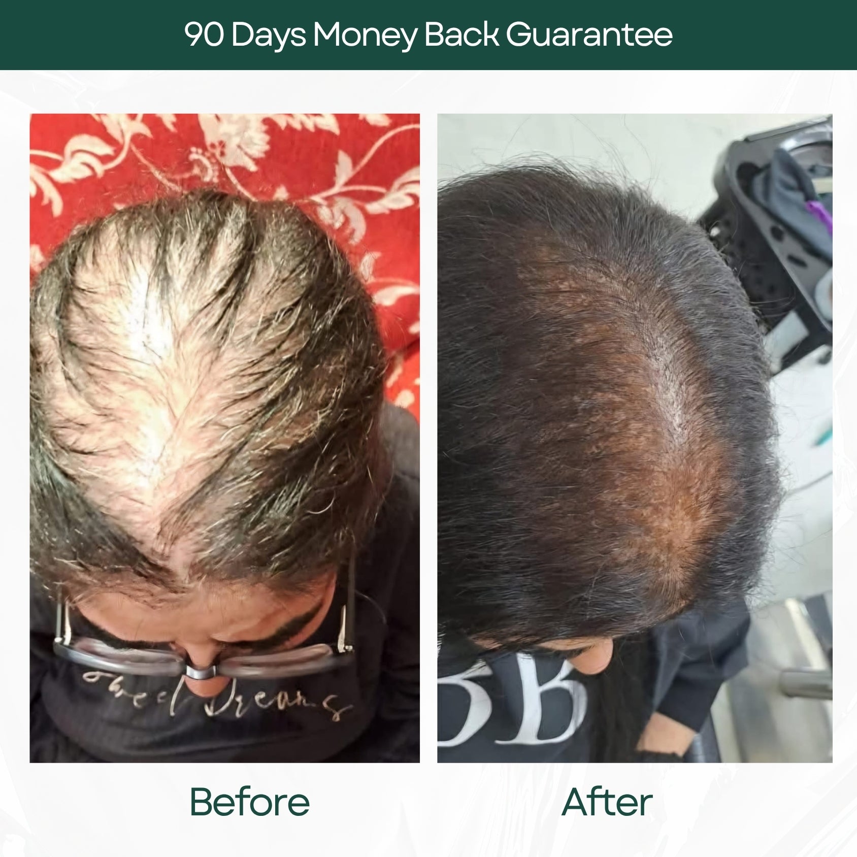 Before and After