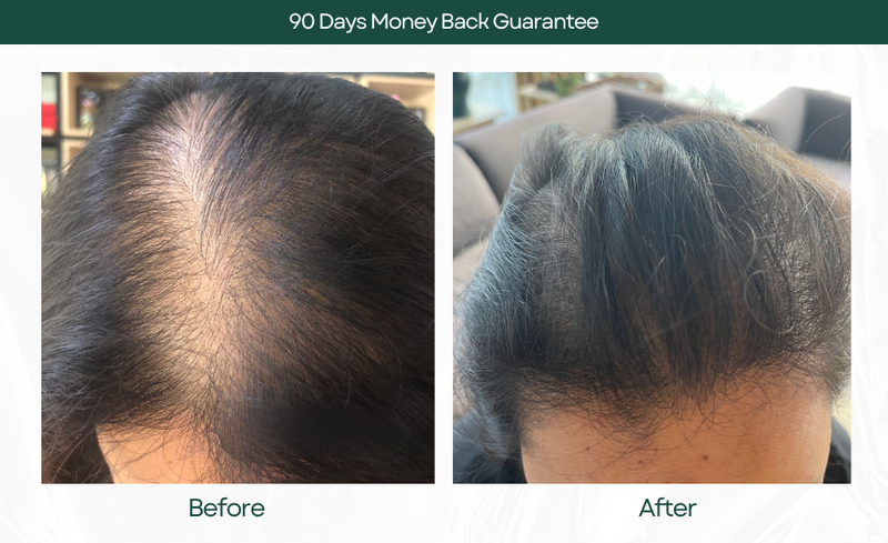 Hair Growth Serum
