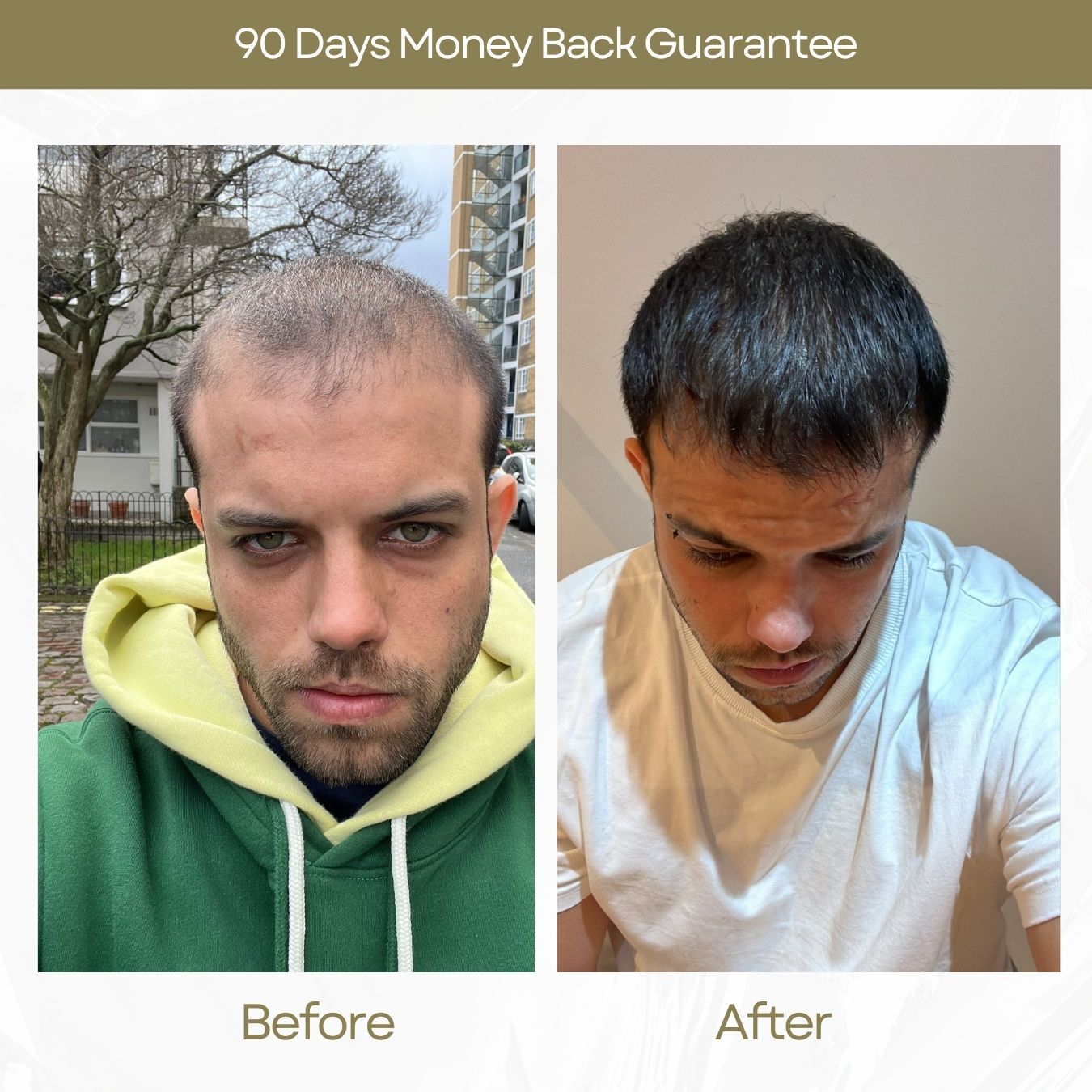 Natural Shampoo For Hair Growth (4 in 1 Set)