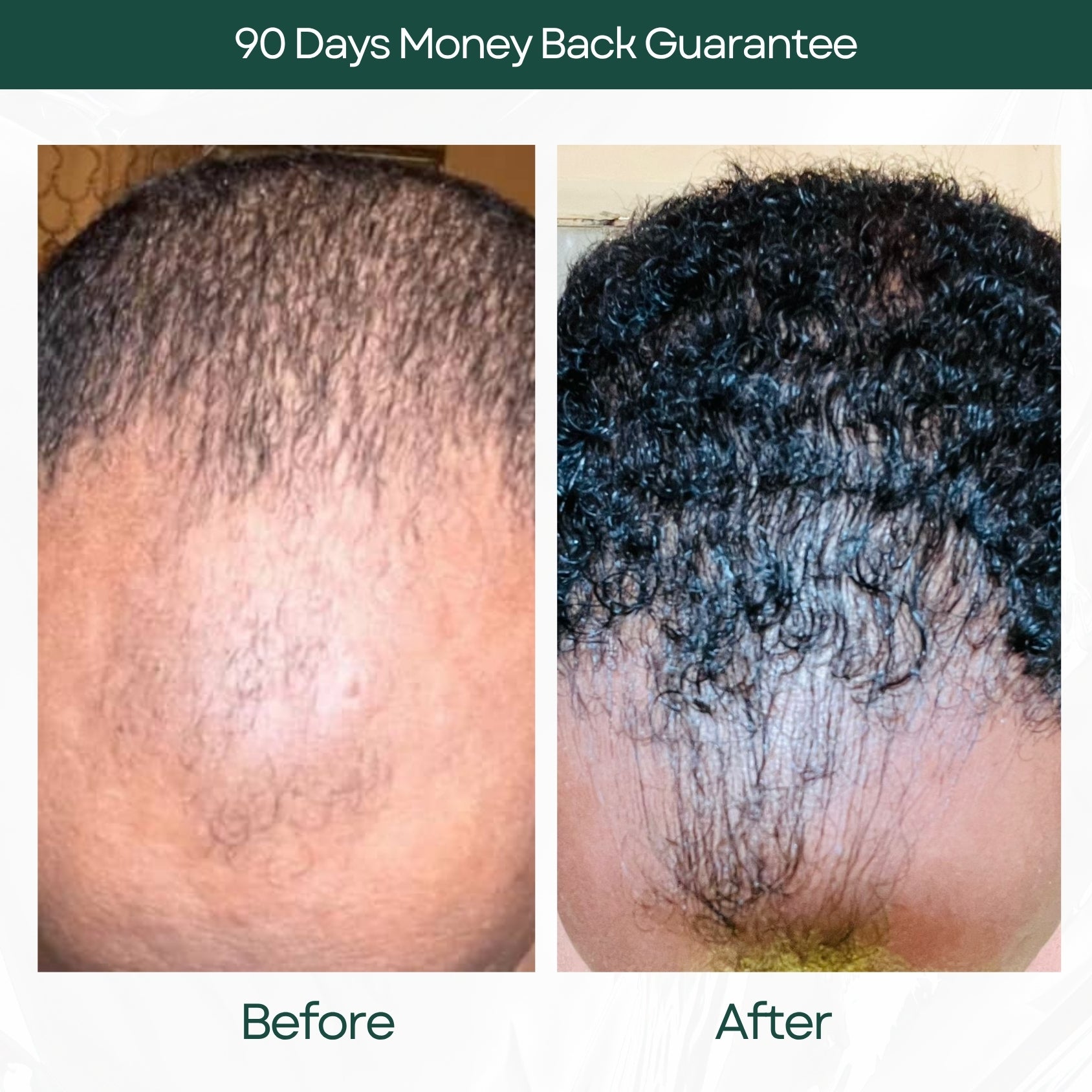 Before and After