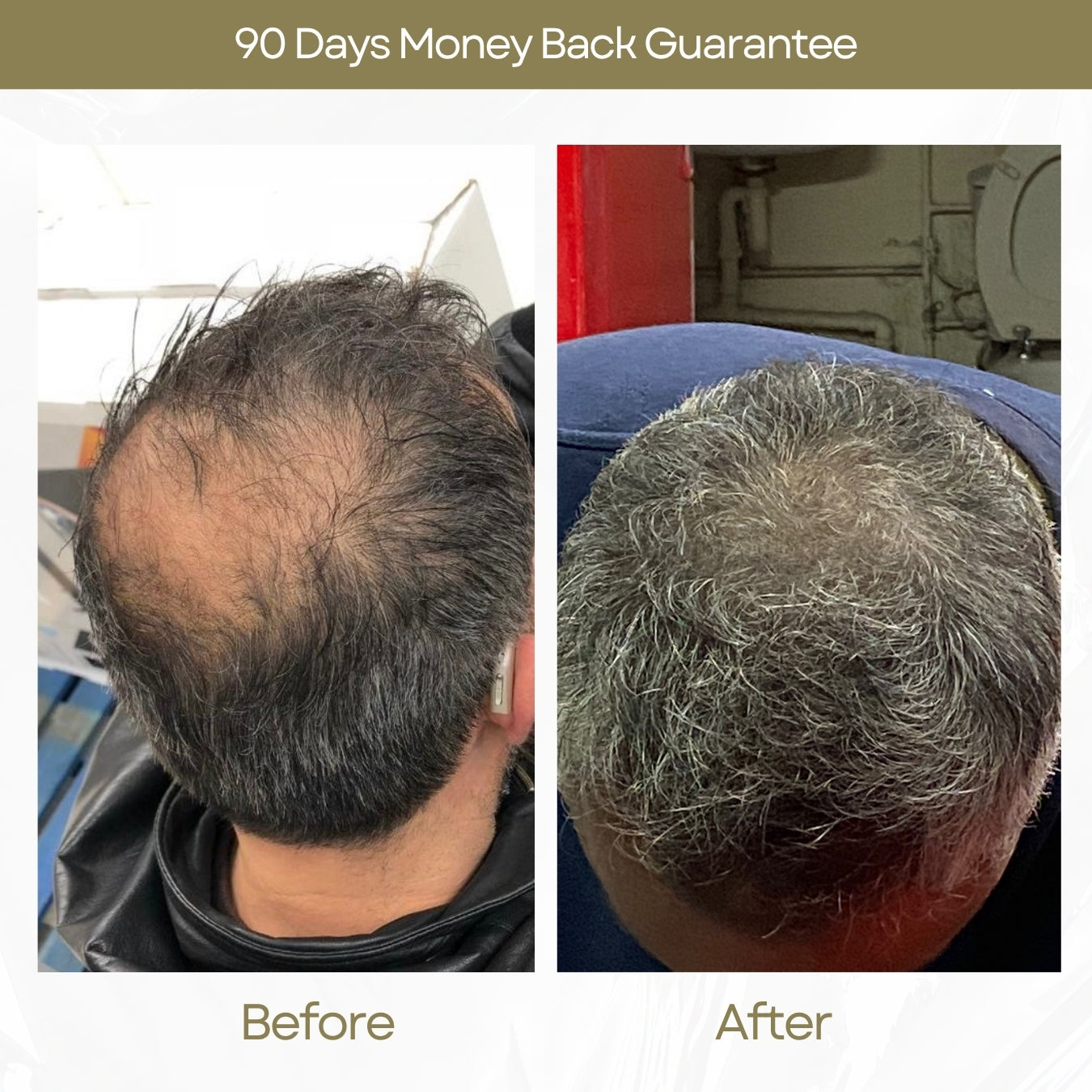 Before and After
