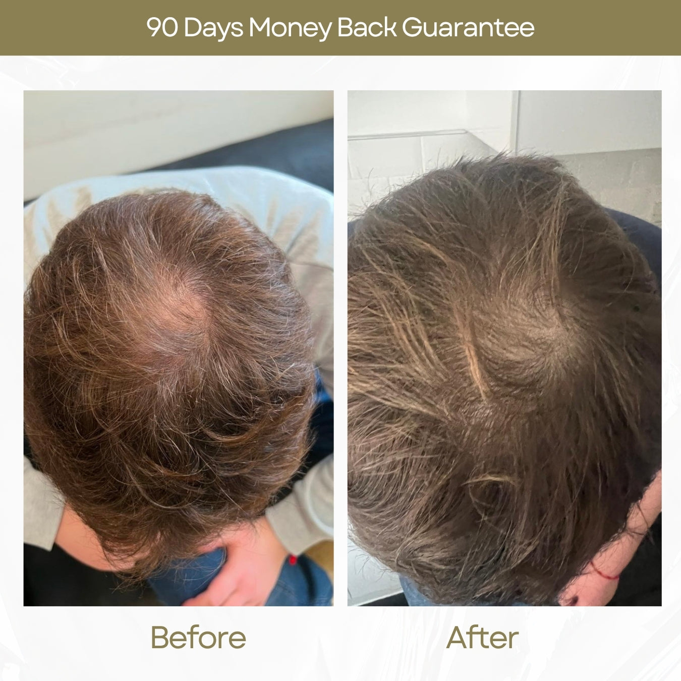 Before and After