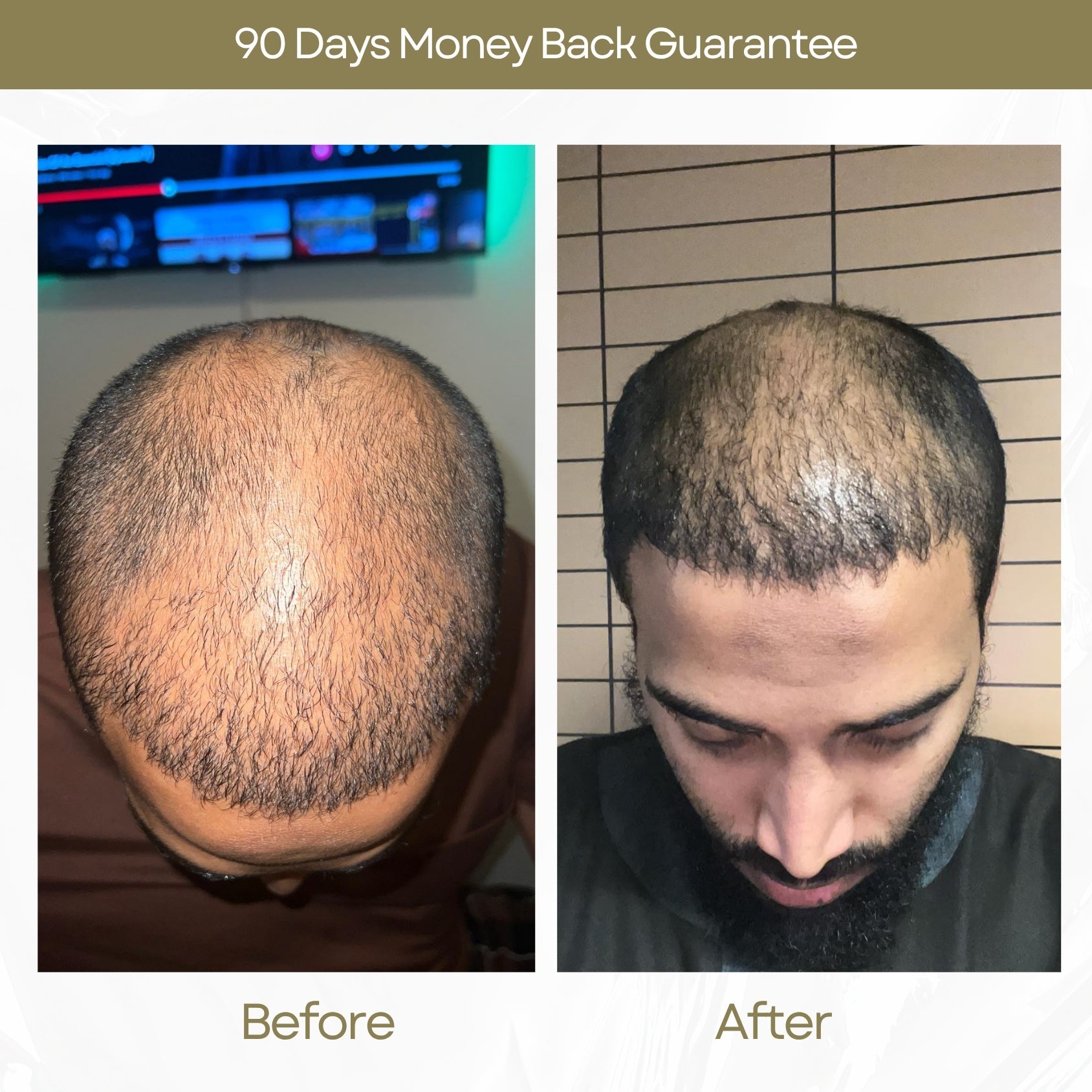 Before and After