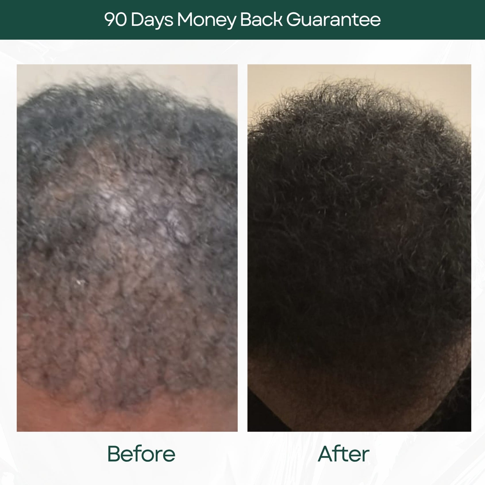 Before and After