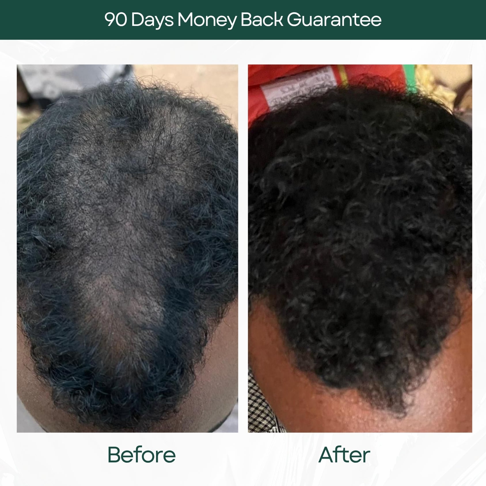 Before and After