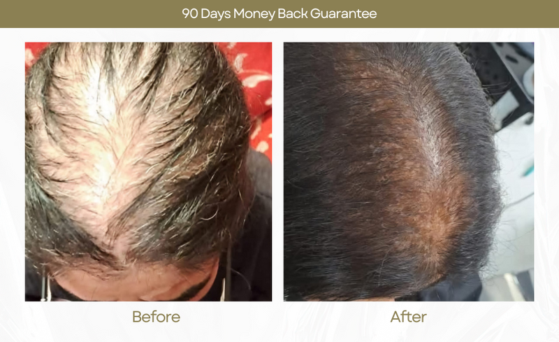 Hair Growth Serum