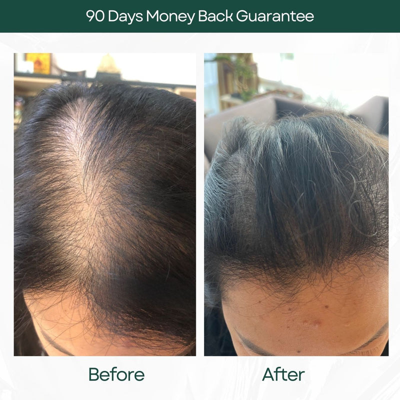 Hair Growth Serum