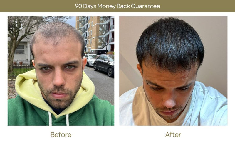 Hair Growth Serum