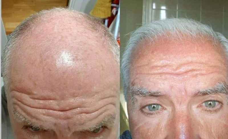 Hair Growth Serum
