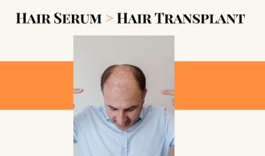 Luxuriant Hair Serum: An Alternative to Hair Transplants for Men