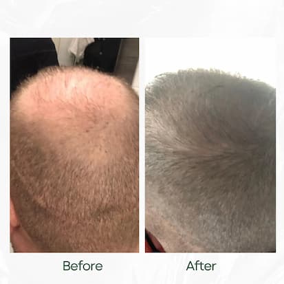 Before and After
