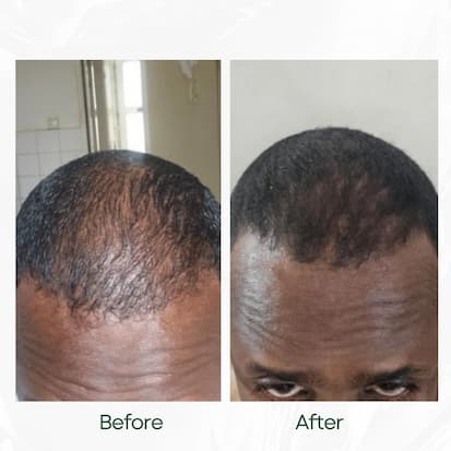 Before and After