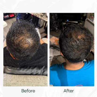 Before and After