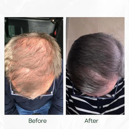 Before and After