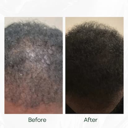 Before and After