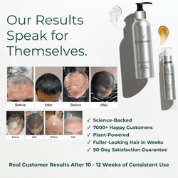 Men’s Hair Growth Set