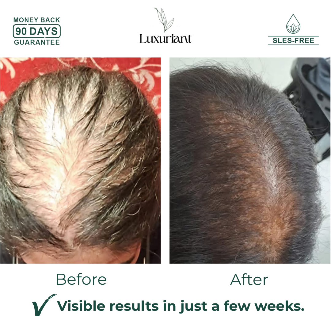 Hair Growth Shampoo for Women