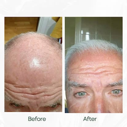 Before and After