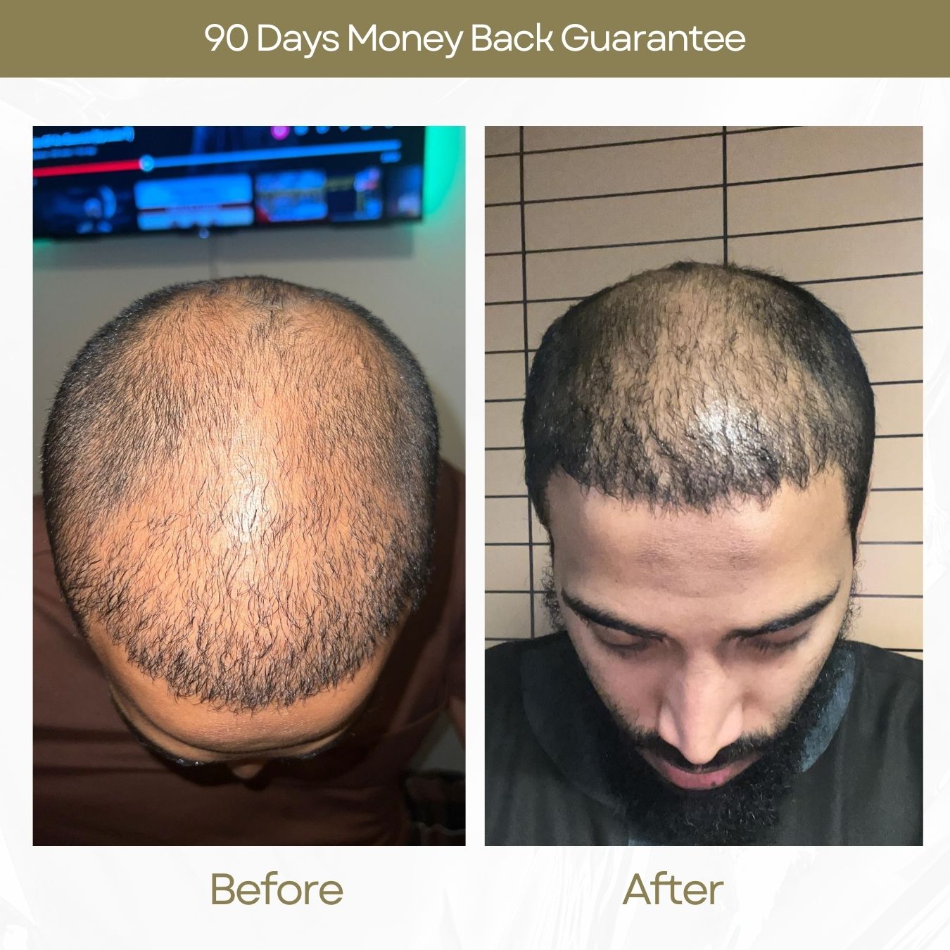 Organic Hair Regrowth Shampoo (Unisex)