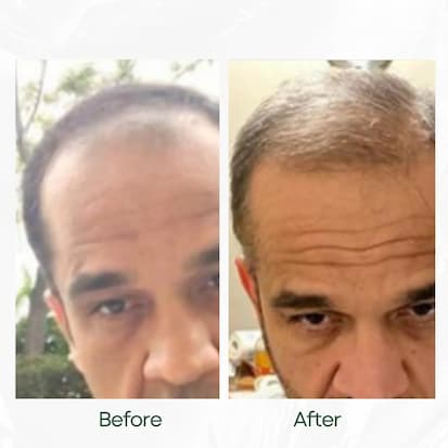 Before and After