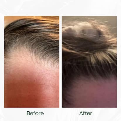Before and After