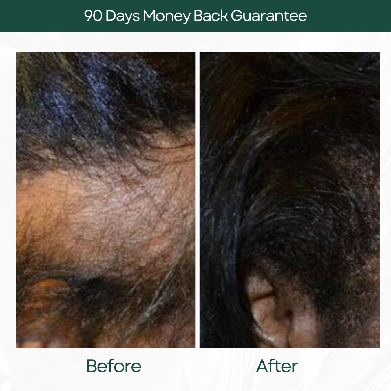 Menopause Hair Serum