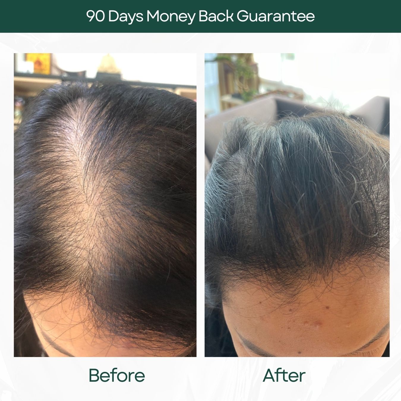 Menopause Shampoo ( 4 in 1 Hair Growth Set )