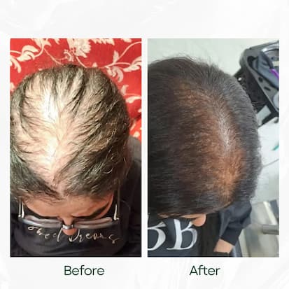 Before and After