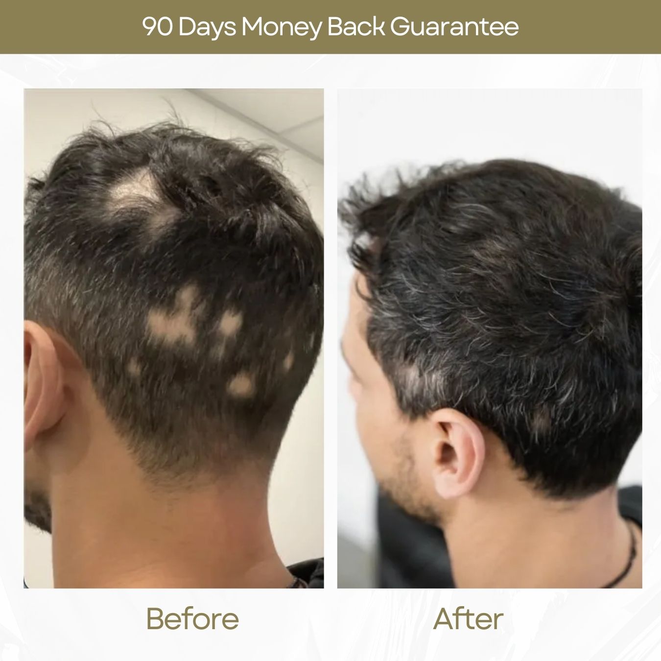Shampoo For Alopecia (Unisex)