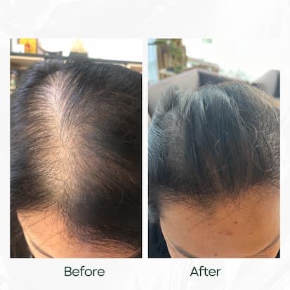 Before and After