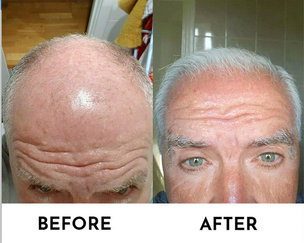 Hair Growth Serum For Men